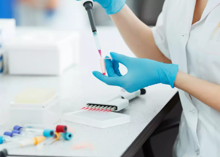 SPST et laboratoires d'analyse